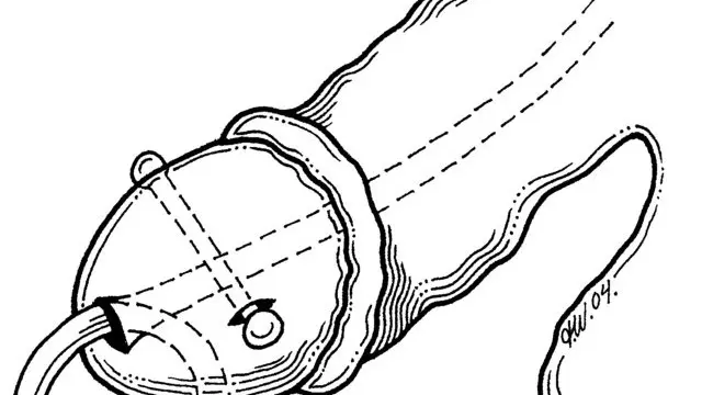 The Dangers of Penis Piercing