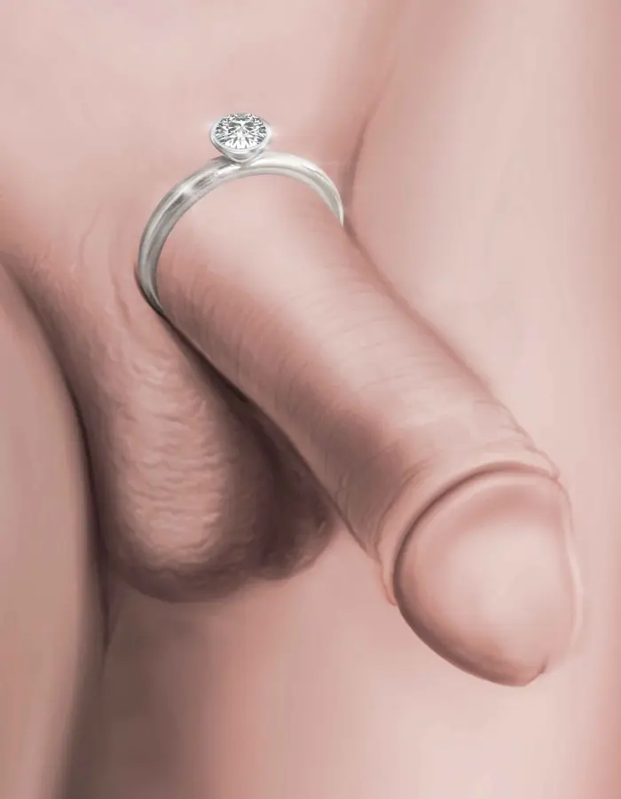 Magnate - Solid Sterling Silver Penis Ring
