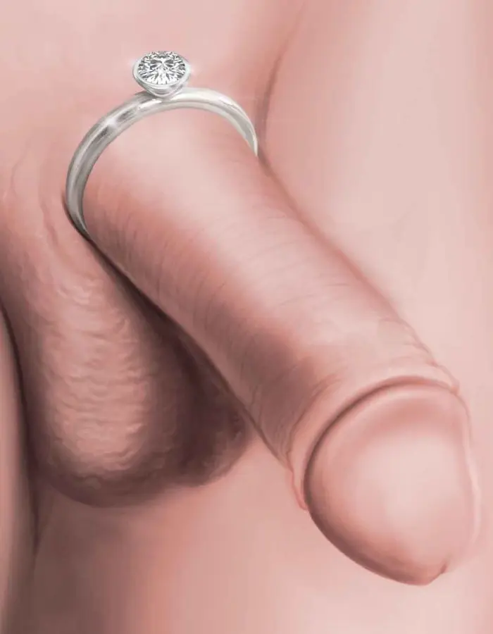 Magnate - Solid Sterling Silver Penis Ring