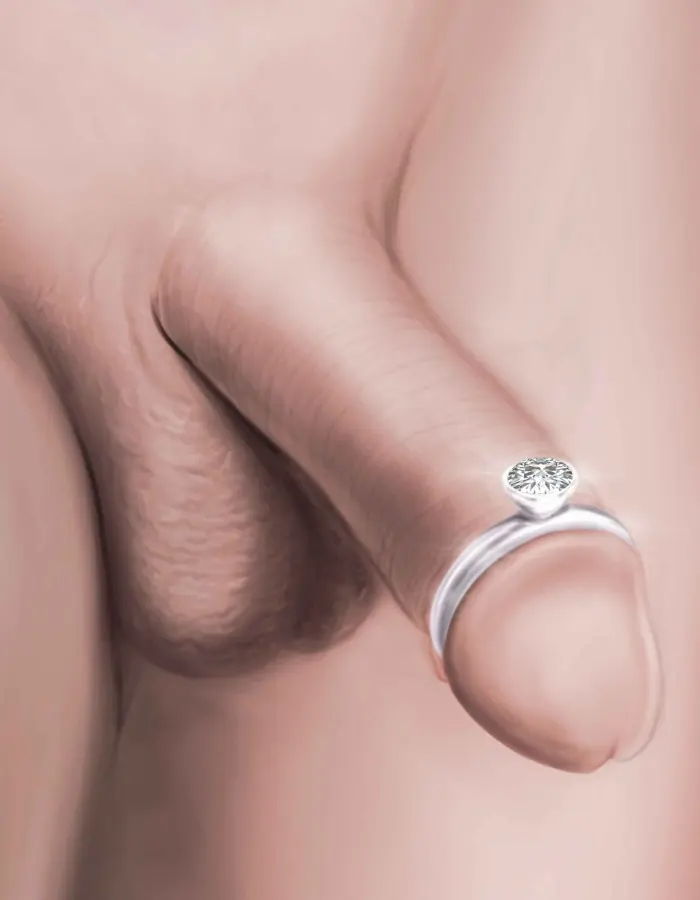 Magnate - Solid Sterling Silver Penis Ring