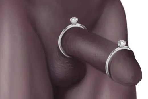 Can I Wear Penis Jewelry While Visiting a Nudist Resort?