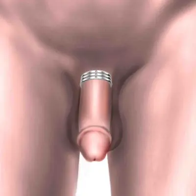 Philanthropist- Solid Sterling Silver Penis Ring