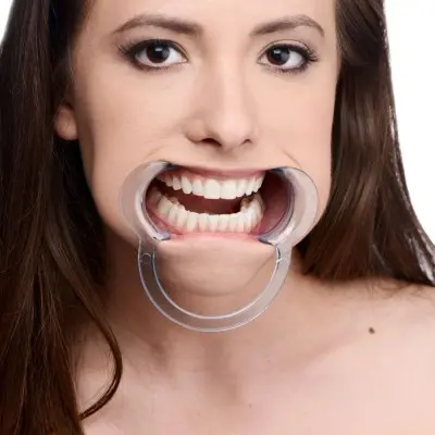 Cheek Retractor