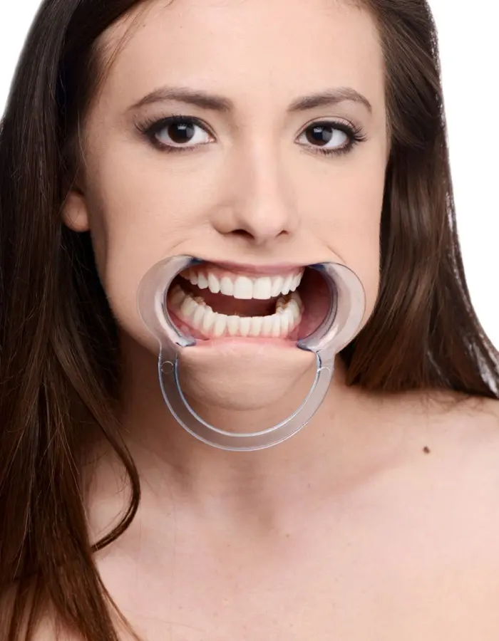 Cheek Retractor
