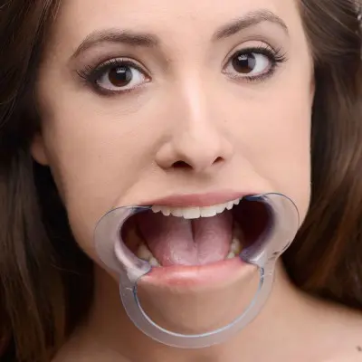 Cheek Retractor