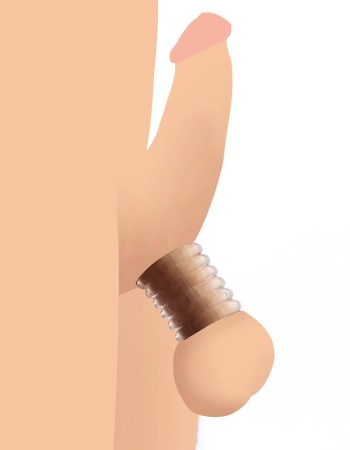 Ms Ring Master Custom Ball Stretching Kit - 6  Ring Pack